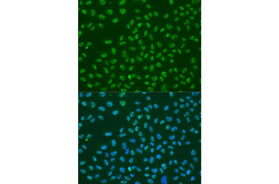 Immunofluorescence - Anti-HuR/ELAVL1 Antibody (A92898) - Antibodies.com