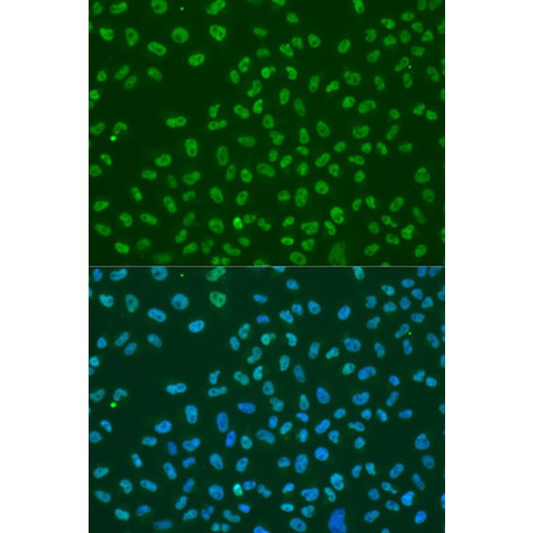 Immunofluorescence - Anti-HuR/ELAVL1 Antibody (A92898) - Antibodies.com