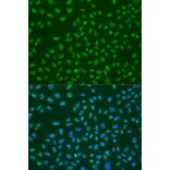 Immunofluorescence - Anti-HuR/ELAVL1 Antibody (A92898) - Antibodies.com