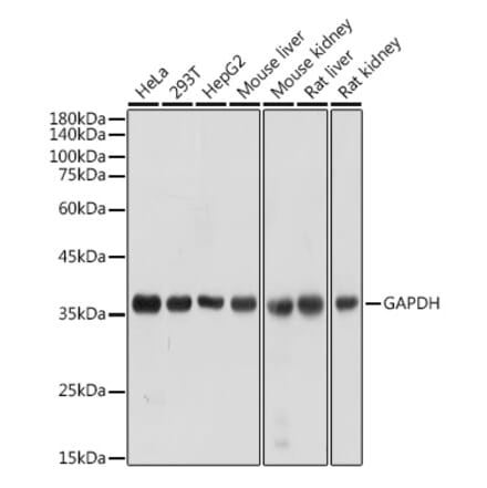 Western Blot - Anti-GAPDH Antibody (A92899) - Antibodies.com