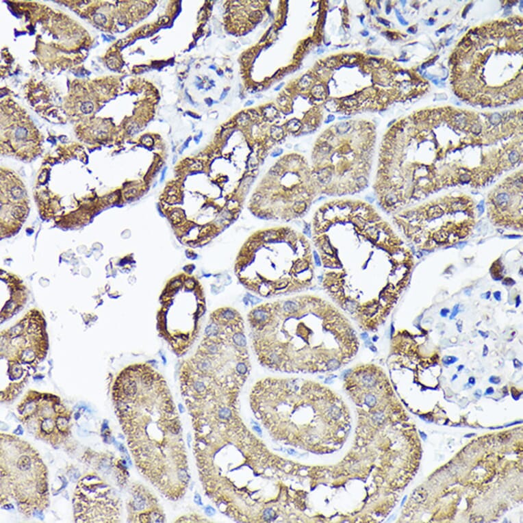 Immunohistochemistry - Anti-GAPDH Antibody (A92899) - Antibodies.com
