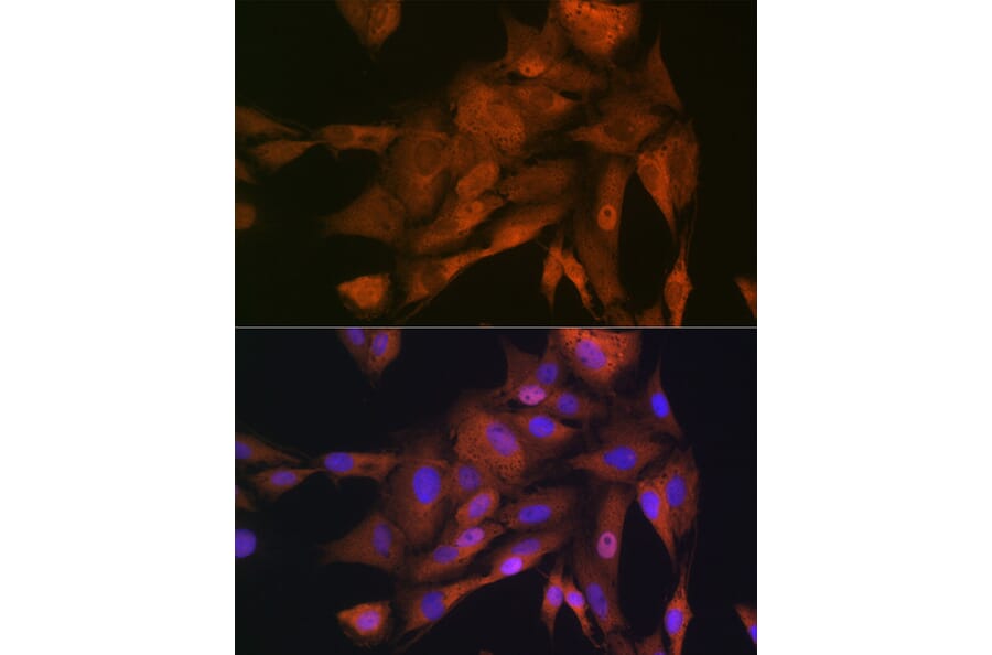 Immunofluorescence - Anti-GAPDH Antibody (A92899) - Antibodies.com