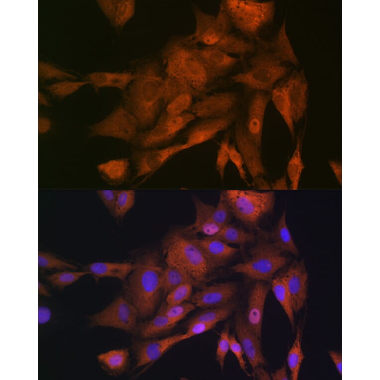 Immunofluorescence - Anti-GAPDH Antibody (A92899) - Antibodies.com
