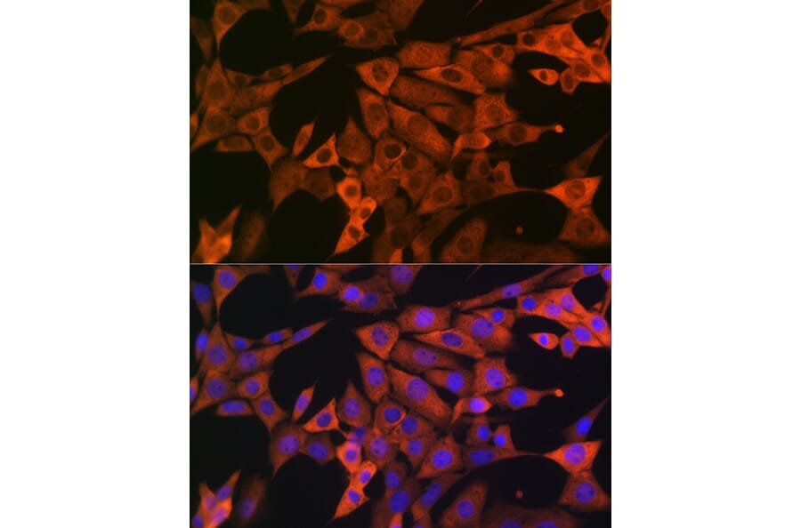 Immunofluorescence - Anti-GAPDH Antibody (A92899) - Antibodies.com