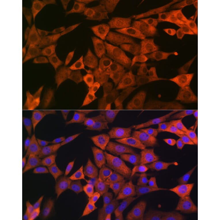 Immunofluorescence - Anti-GAPDH Antibody (A92899) - Antibodies.com