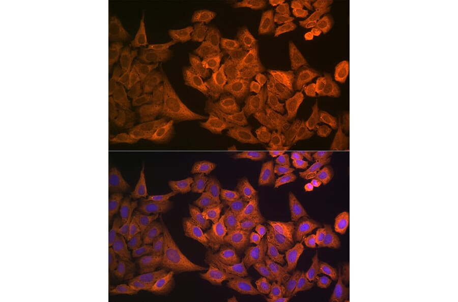 Immunofluorescence - Anti-GAPDH Antibody (A92899) - Antibodies.com