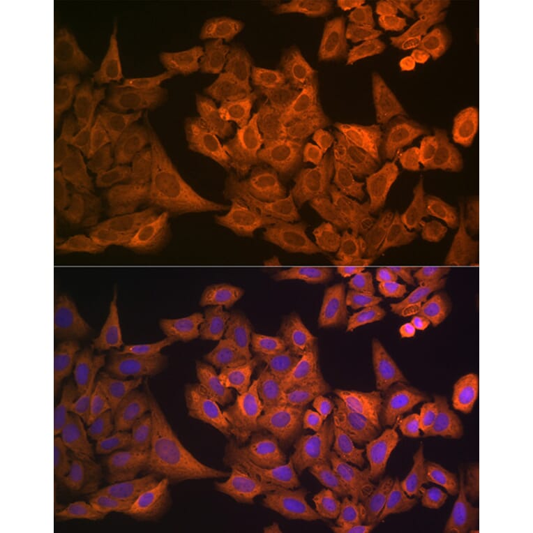 Immunofluorescence - Anti-GAPDH Antibody (A92899) - Antibodies.com