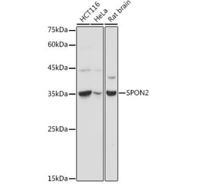 Western Blot - Anti-SPON2 Antibody (A92902) - Antibodies.com