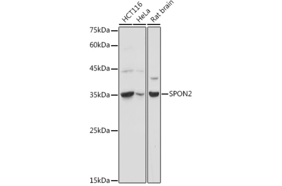 Western Blot - Anti-SPON2 Antibody (A92902) - Antibodies.com