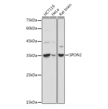 Western Blot - Anti-SPON2 Antibody (A92902) - Antibodies.com