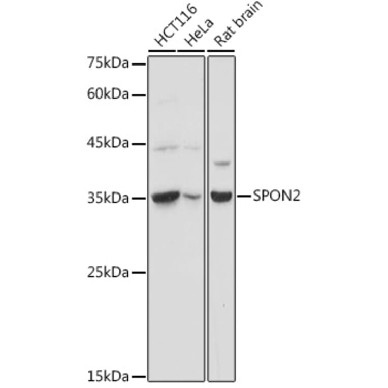 Western Blot - Anti-SPON2 Antibody (A92902) - Antibodies.com