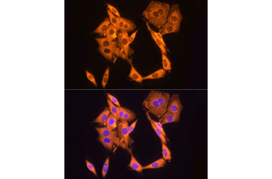 Immunofluorescence - Anti-GAPDH Antibody [AMC0062] (A92903) - Antibodies.com