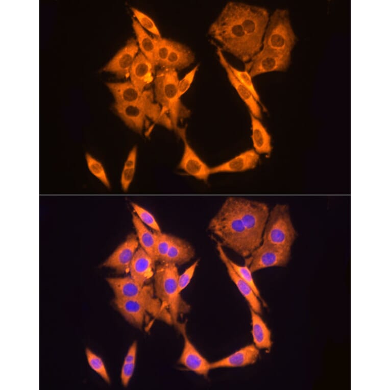 Immunofluorescence - Anti-GAPDH Antibody [AMC0062] (A92903) - Antibodies.com