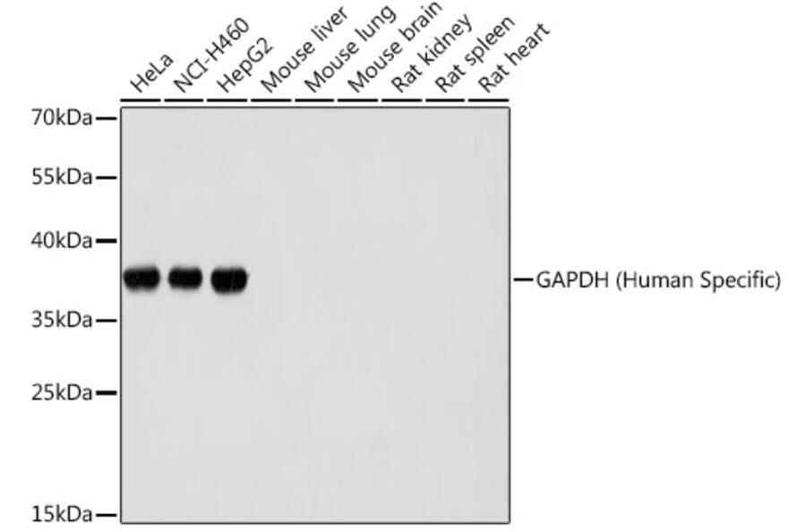 Western Blot - Anti-GAPDH Antibody (A92905) - Antibodies.com