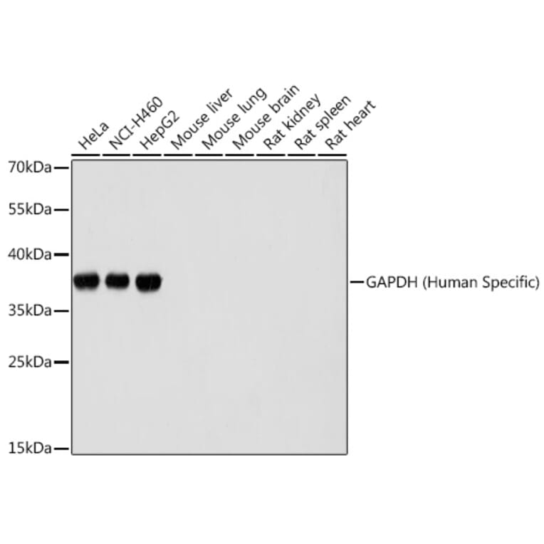 Western Blot - Anti-GAPDH Antibody (A92905) - Antibodies.com