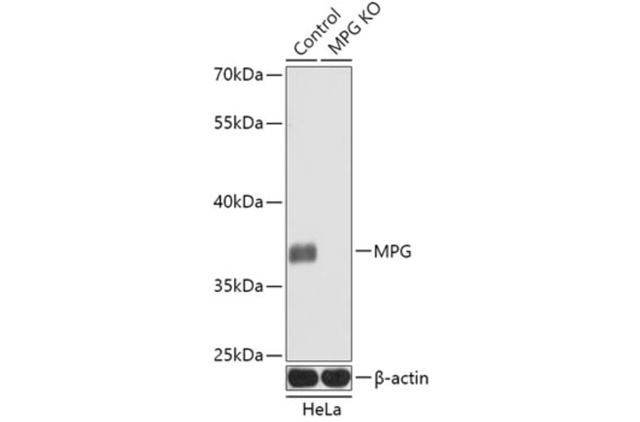 Western Blot - Anti-MPG/AAG Antibody (A92907) - Antibodies.com