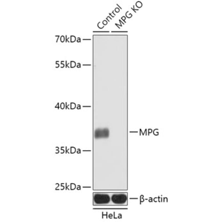 Western Blot - Anti-MPG/AAG Antibody (A92907) - Antibodies.com