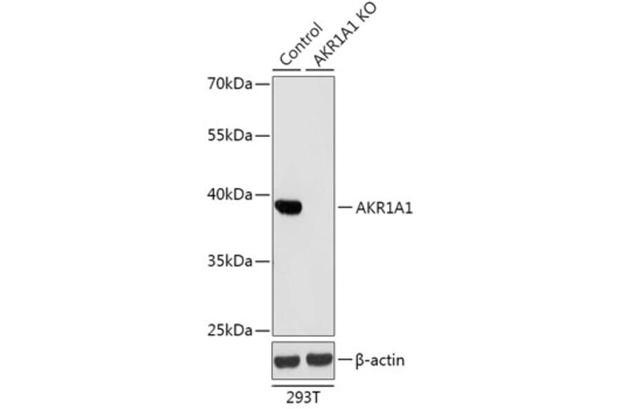 Western Blot - Anti-AKR1A1 Antibody (A92908) - Antibodies.com