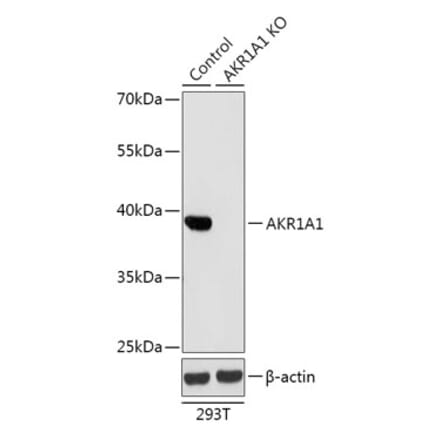 Western Blot - Anti-AKR1A1 Antibody (A92908) - Antibodies.com