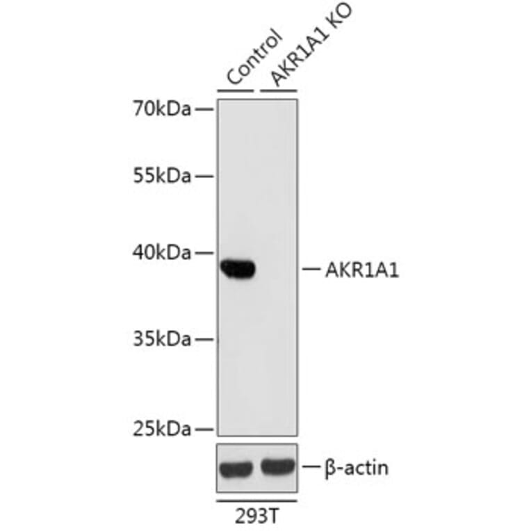 Western Blot - Anti-AKR1A1 Antibody (A92908) - Antibodies.com