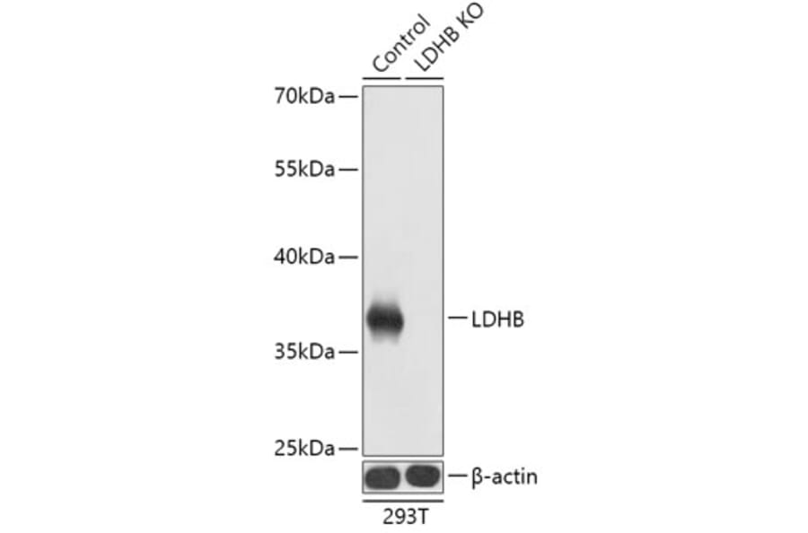Western Blot - Anti-Lactate Dehydrogenase B/LDH-B Antibody (A92909) - Antibodies.com