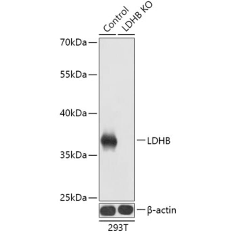 Western Blot - Anti-Lactate Dehydrogenase B/LDH-B Antibody (A92909) - Antibodies.com