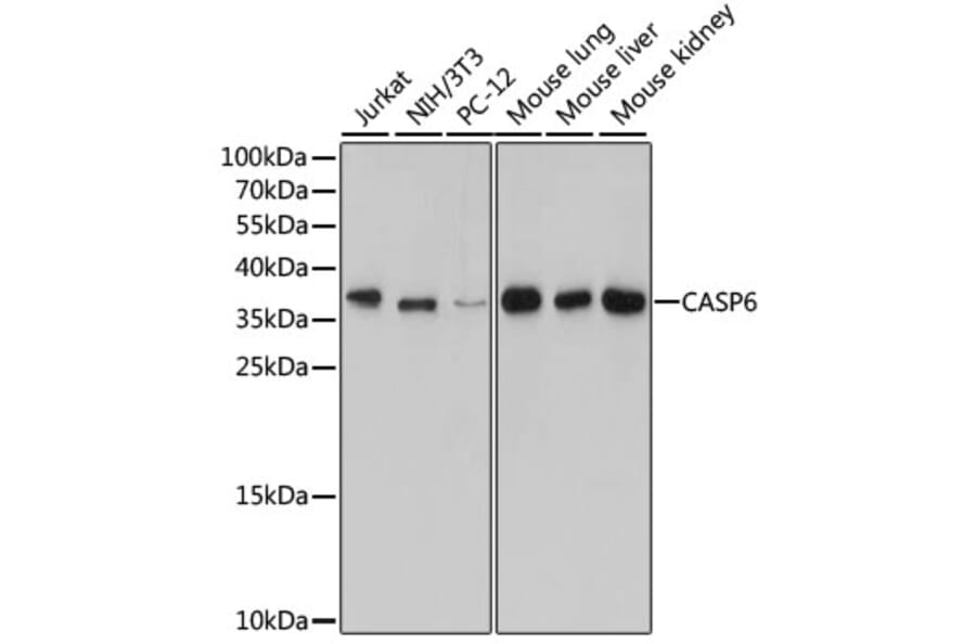 Western Blot - Anti-CASP6 Antibody (A12991) - Antibodies.com