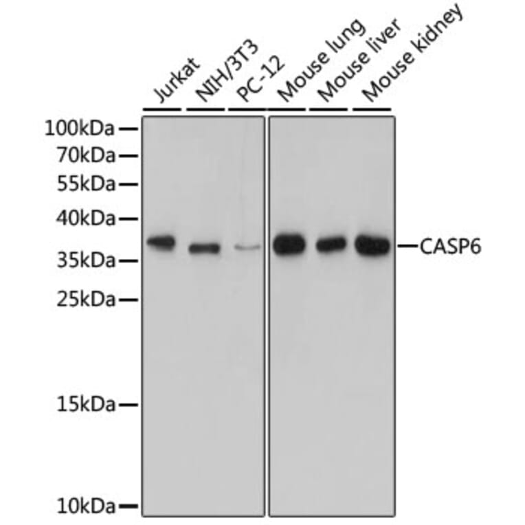 Western Blot - Anti-CASP6 Antibody (A12991) - Antibodies.com