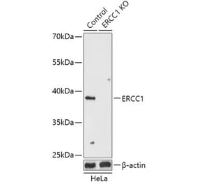Western Blot - Anti-ERCC1 Antibody (A92913) - Antibodies.com
