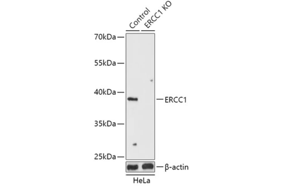 Western Blot - Anti-ERCC1 Antibody (A92913) - Antibodies.com