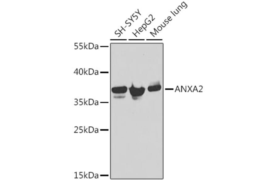 Western Blot - Anti-ANXA2 Antibody (A12397) - Antibodies.com