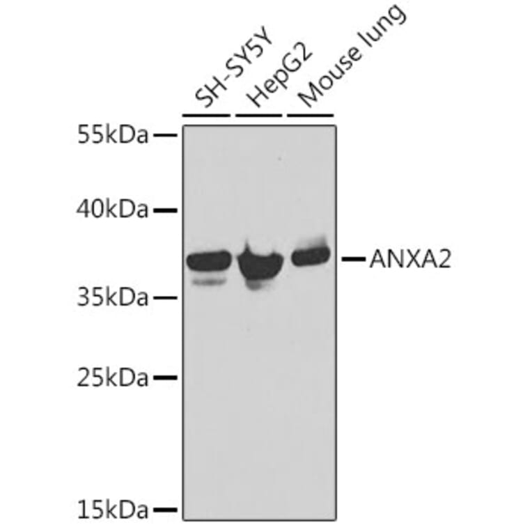 Western Blot - Anti-ANXA2 Antibody (A12397) - Antibodies.com