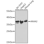 Western Blot - Anti-ANXA2 Antibody (A12397) - Antibodies.com