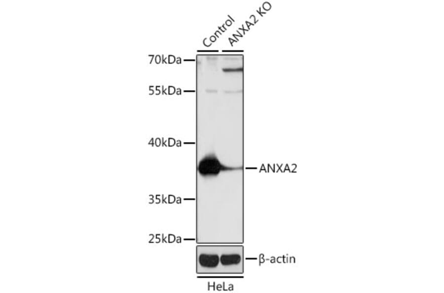 Western Blot - Anti-ANXA2 Antibody (A12397) - Antibodies.com