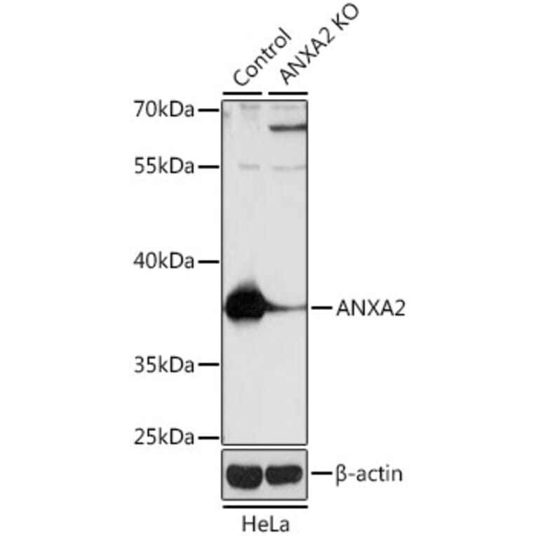 Western Blot - Anti-ANXA2 Antibody (A12397) - Antibodies.com