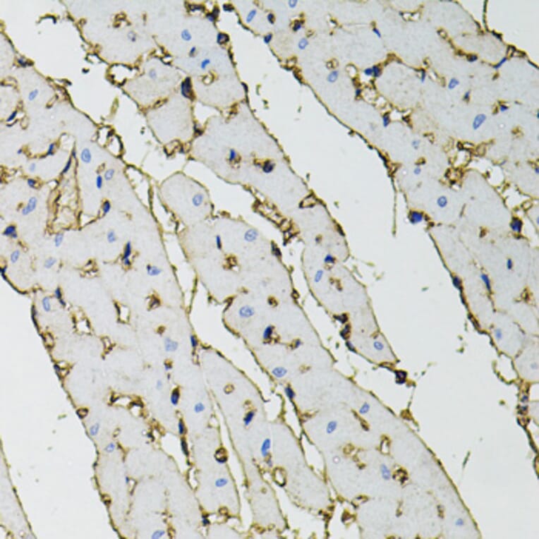 Immunohistochemistry - Anti-ANXA2 Antibody (A12397) - Antibodies.com