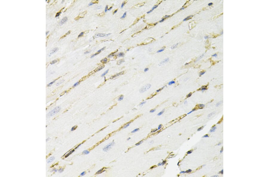Immunohistochemistry - Anti-ANXA2 Antibody (A12397) - Antibodies.com