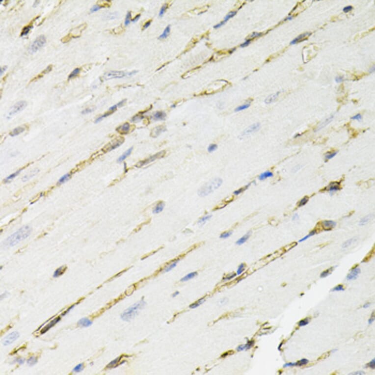 Immunohistochemistry - Anti-ANXA2 Antibody (A12397) - Antibodies.com