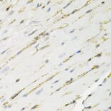 Immunohistochemistry - Anti-ANXA2 Antibody (A12397) - Antibodies.com