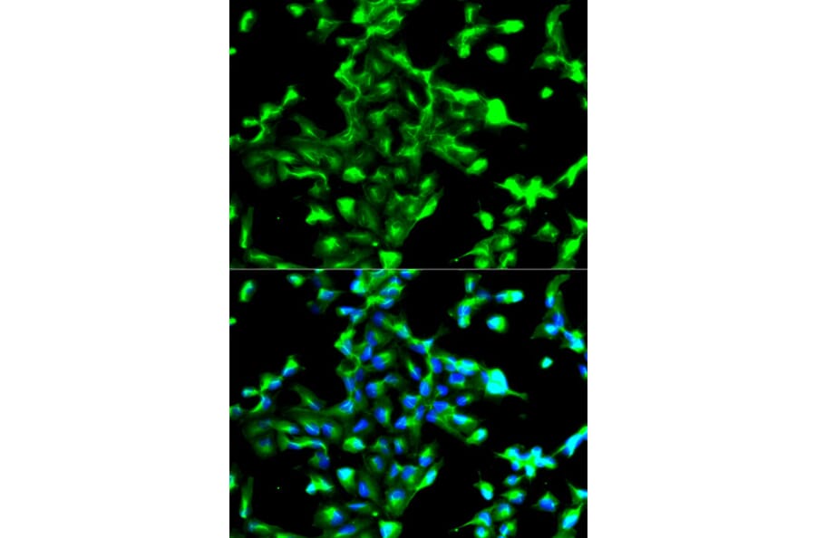 Immunofluorescence - Anti-ANXA2 Antibody (A12397) - Antibodies.com