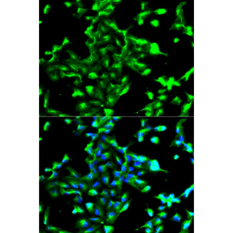 Immunofluorescence - Anti-ANXA2 Antibody (A12397) - Antibodies.com