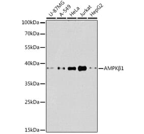 Western Blot - Anti-AMPK beta 1 Antibody (A92916) - Antibodies.com