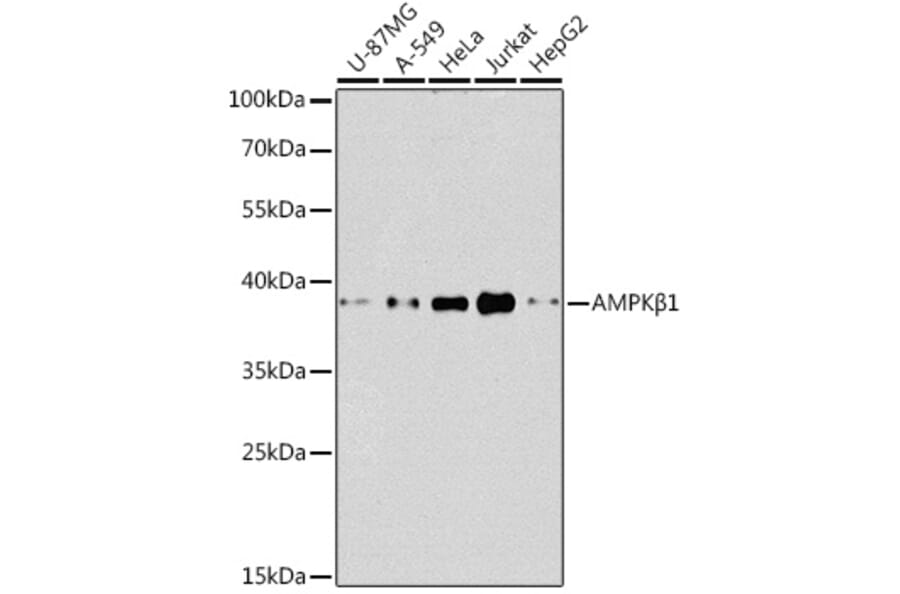Western Blot - Anti-AMPK beta 1 Antibody (A92916) - Antibodies.com