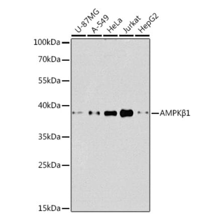 Western Blot - Anti-AMPK beta 1 Antibody (A92916) - Antibodies.com