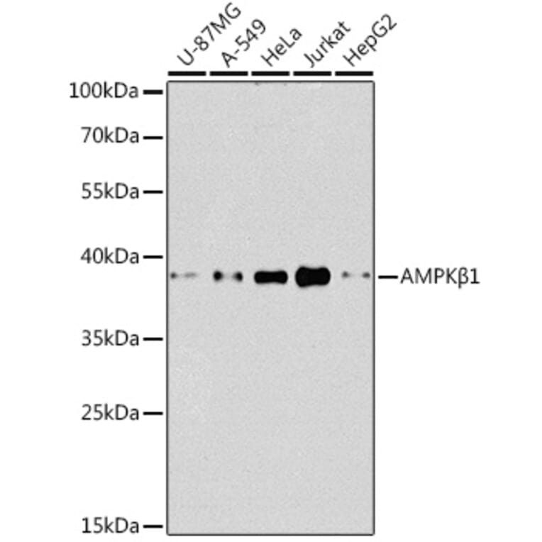 Western Blot - Anti-AMPK beta 1 Antibody (A92916) - Antibodies.com