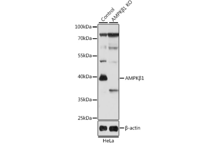 Western Blot - Anti-AMPK beta 1 Antibody (A92916) - Antibodies.com