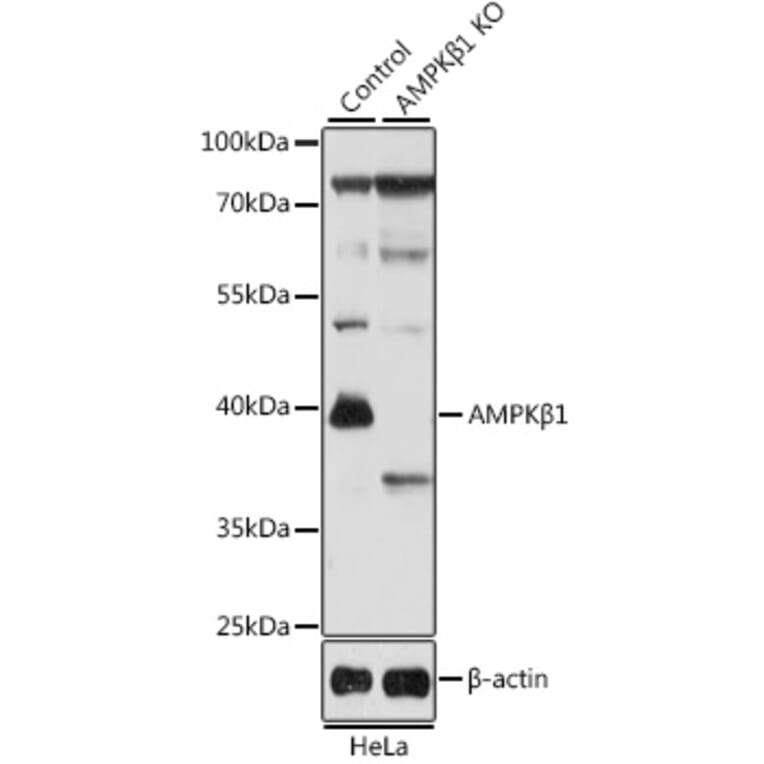 Western Blot - Anti-AMPK beta 1 Antibody (A92916) - Antibodies.com