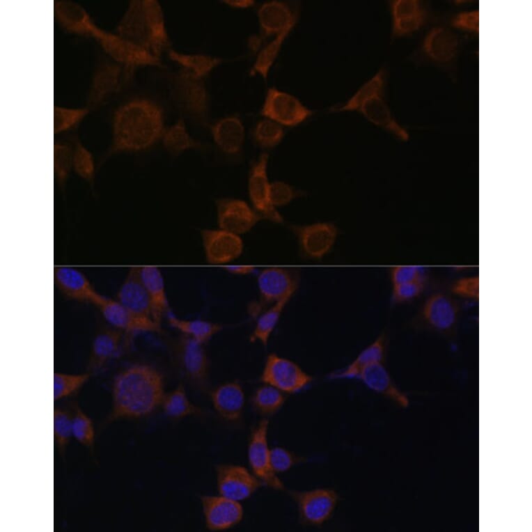 Immunofluorescence - Anti-AMPK beta 1 Antibody (A92916) - Antibodies.com