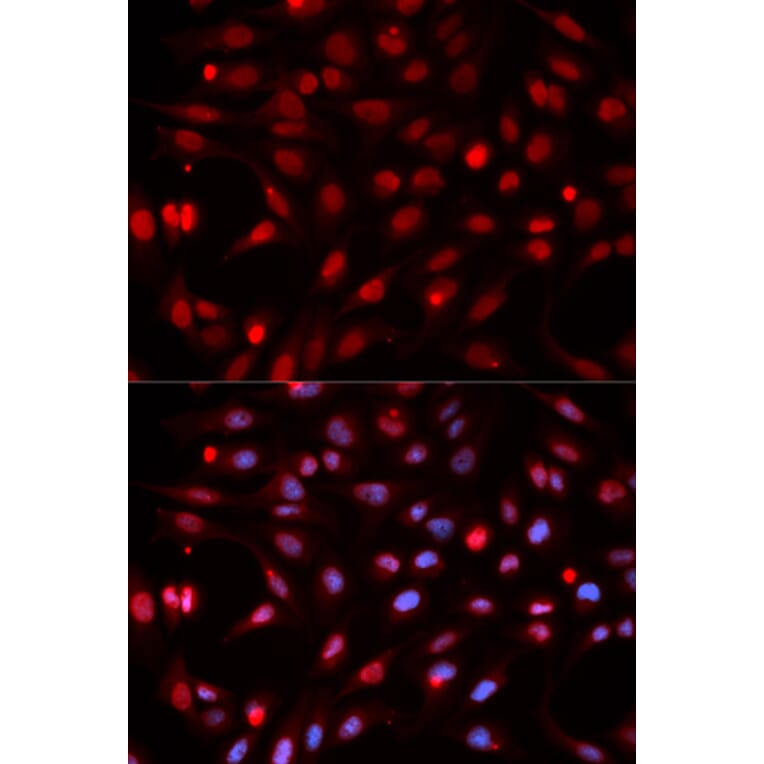 Immunofluorescence - Anti-APE1 Antibody (A92917) - Antibodies.com