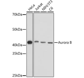 Western Blot - Anti-Aurora B Antibody (A92918) - Antibodies.com